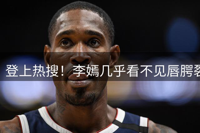 登上热搜！李嫣几乎看不见唇腭裂修复痕迹